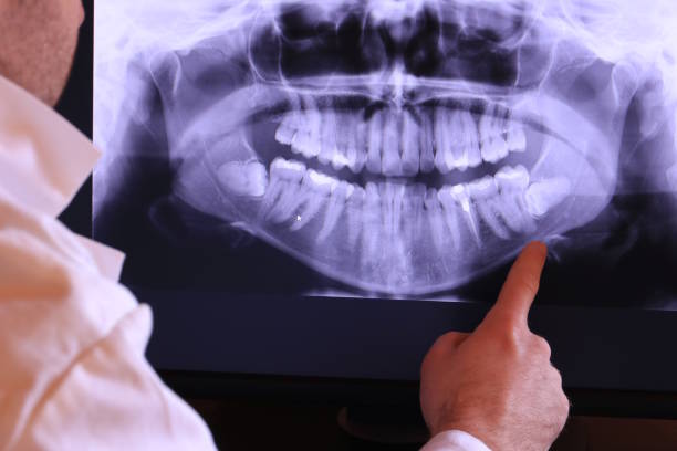 Best Pediatric Emergency Dentist in Monmouth Junction, NJ