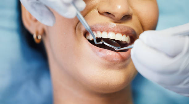 Best Urgent Care for Lost Fillings or Crowns in Monmouth Junction, NJ