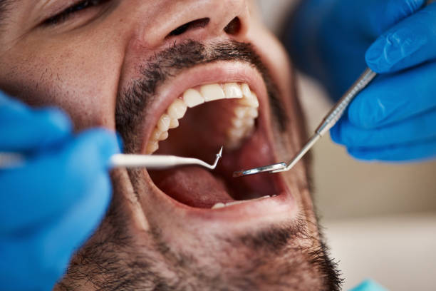 Best Emergency Denture Repair in Monmouth Junction, NJ